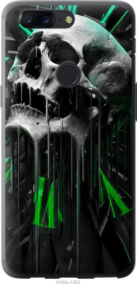 Чехол на OnePlus 5T Череп-часы