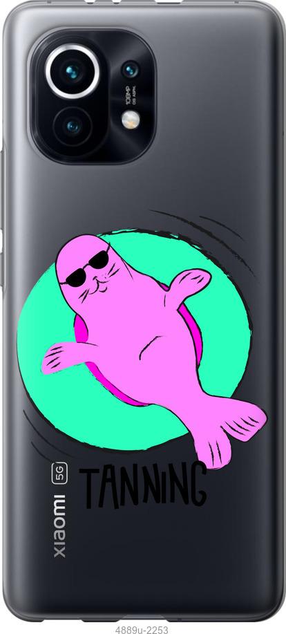 Чехол на Xiaomi Mi 11 Magic Time