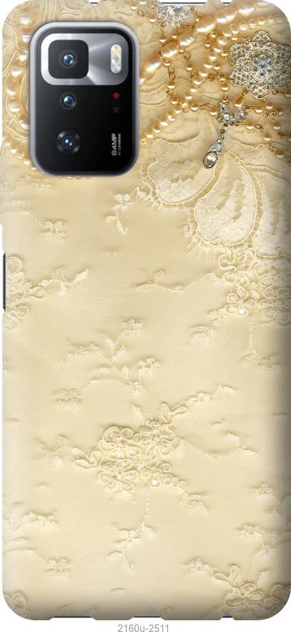 

Чехол на Xiaomi Poco X3 GT Кружевной орнамент