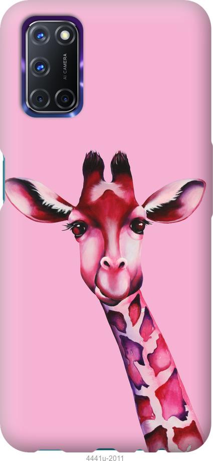 

Чохол на Oppo A72 Рожева жирафа