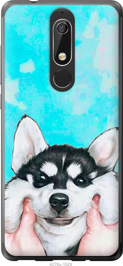 Чехол на Nokia 5.1 Улыбнись