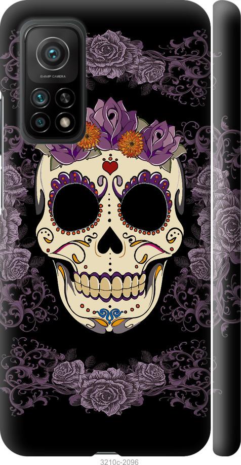 

Чохол на Xiaomi Mi 10T Sugarskull