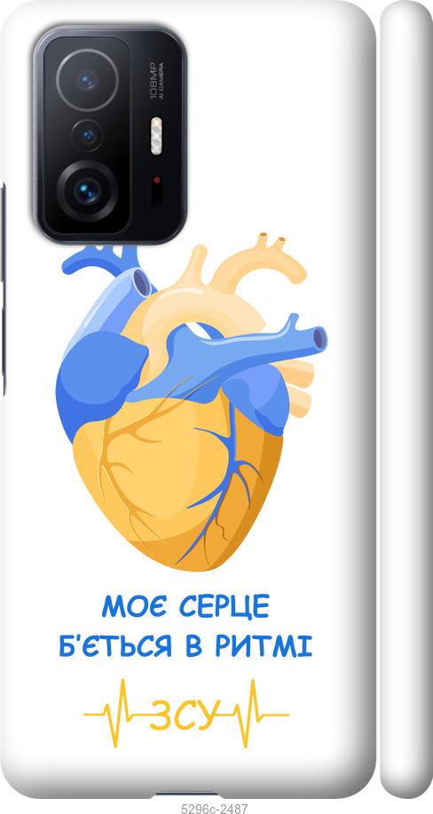 

Чохол на Xiaomi 11T Серце v2