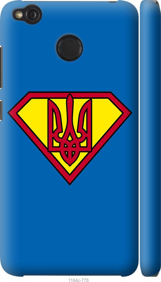 

Чохол на Xiaomi Redmi 4X Супер Тризуб