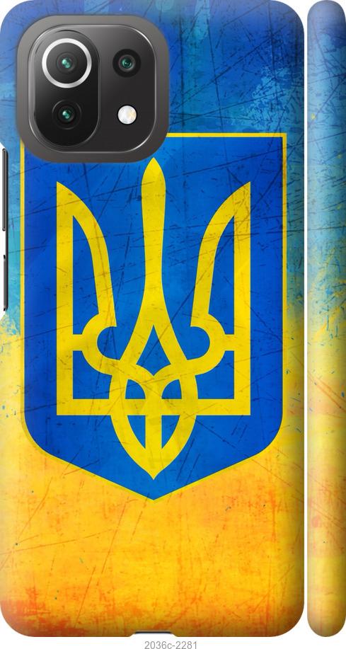 

Чохол на Xiaomi Mi 11 Lite Герб України