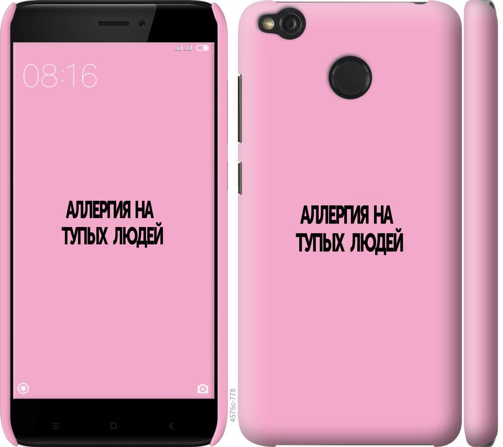 

Чохол на Xiaomi Redmi 4X алергія