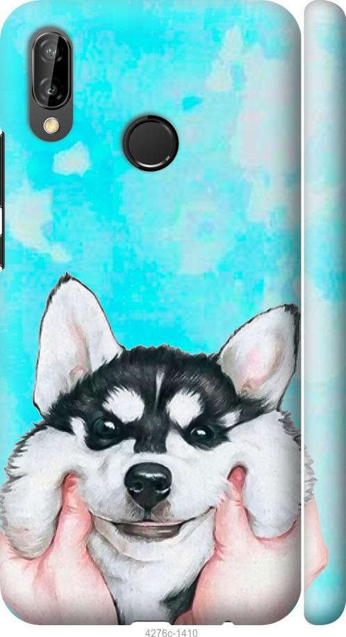 

Чехол на Huawei P20 Lite Улыбнись