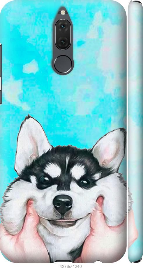 

Чехол на Huawei Mate 10 Lite Улыбнись