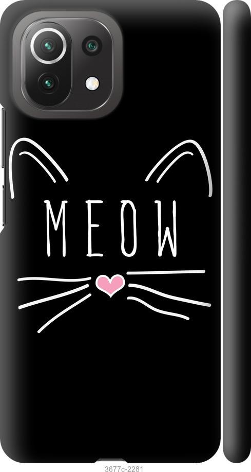 

Чехол на Xiaomi Mi 11 Lite Kitty