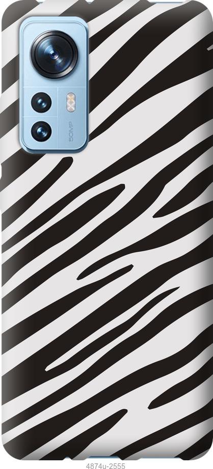 Чехол на Xiaomi 12 Классическая зебра