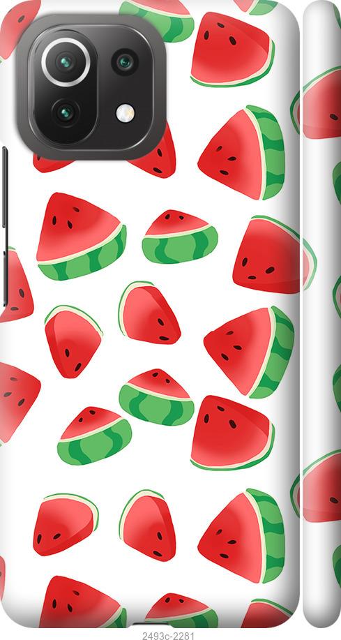 

Чохол на Xiaomi Mi 11 Lite Кавун