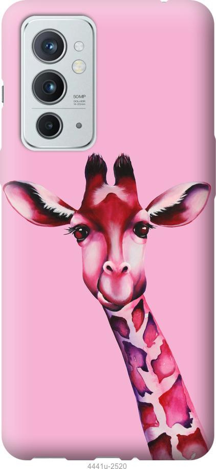 

Чохол на OnePlus 9RT Рожева жирафа