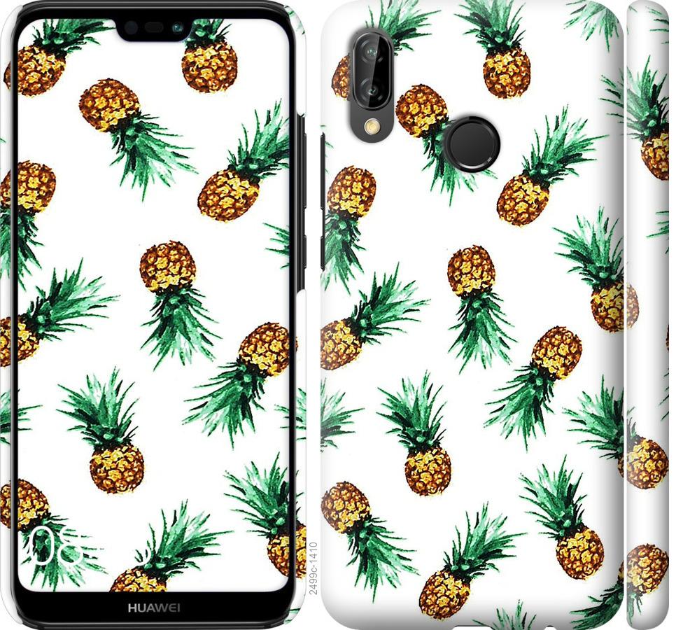 

Чохол на Huawei P20 Lite ананас