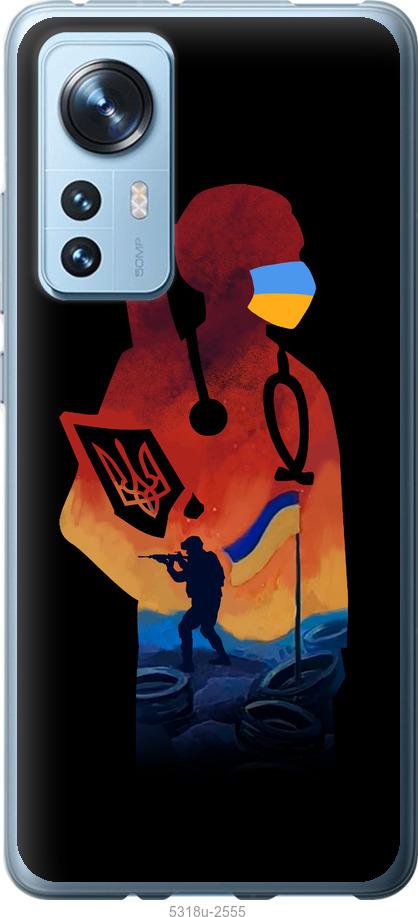 

Чохол на Xiaomi 12 Лікар-волонтер