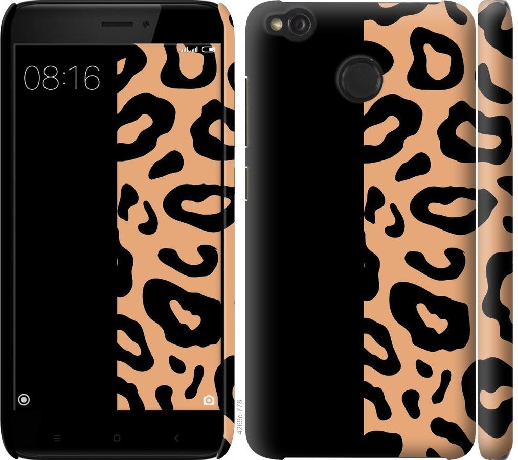 

Чохол на Xiaomi Redmi 4X Плями леопарда