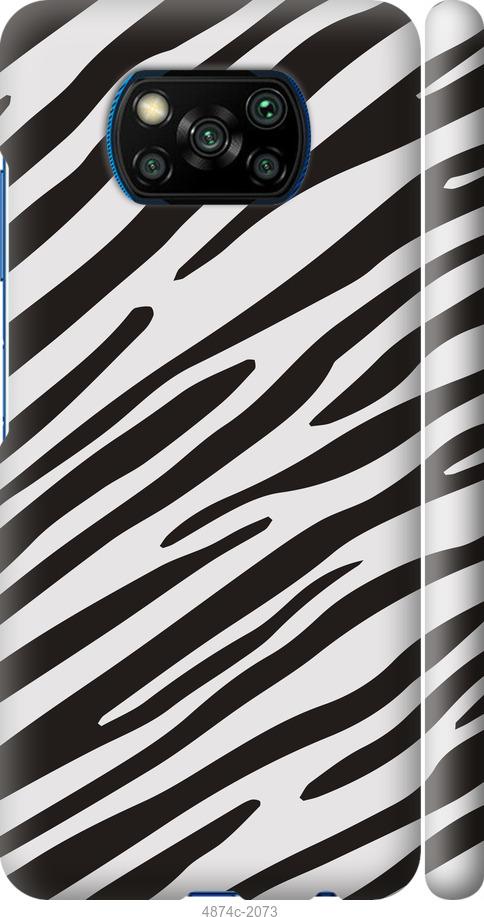 Чехол на Xiaomi Poco X3 Классическая зебра