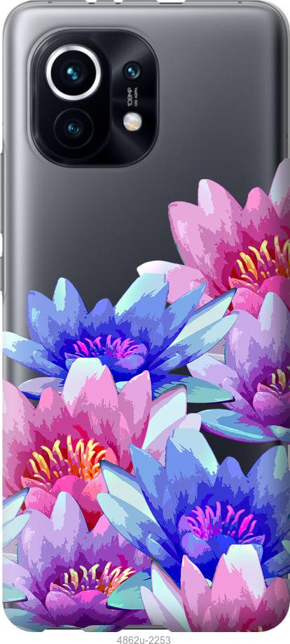 Чехол на Xiaomi Mi 11 Лотос
