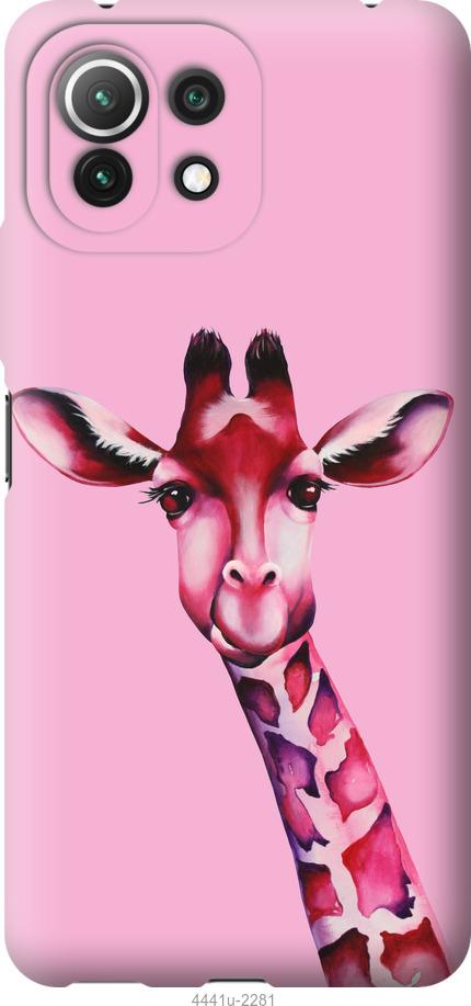Чехол на Xiaomi Mi 11 Lite Розовая жирафа