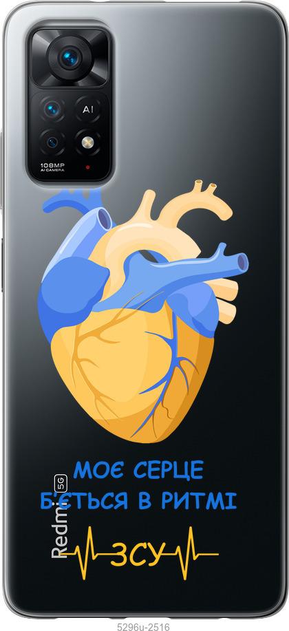 Чохол на Xiaomi Redmi Note 11 Серце v2
